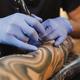 Negligencias estéticas: consecuencias de un tatuaje mal hecho